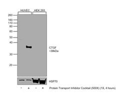 Invitrogen CTGF Polyclonal Antibody 100 &mu;L; Unconjugated:Antibodies,