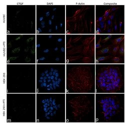 Invitrogen CTGF Polyclonal Antibody 100 &mu;L; Unconjugated:Antibodies,