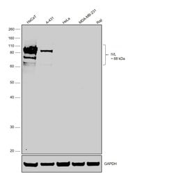 Invitrogen Involucrin Polyclonal Antibody 1 mL; Unconjugated:Antibodies,