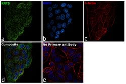 Invitrogen Cytokeratin 5 Polyclonal Antibody 1 mL; Unconjugated:Antibodies,