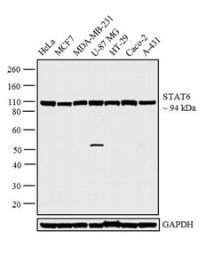 Invitrogen STAT6 Polyclonal Antibody:Antibodies:Primary Antibodies