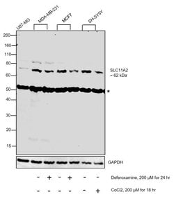 Invitrogen SLC11A2 Polyclonal Antibody 50 &mu;g; Unconjugated:Antibodies,
