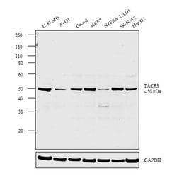 Invitrogen TACR3 Polyclonal Antibody 50 &mu;g | Buy Online | Invitrogen&trade; | Fisher Scientific