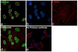 TRIM28 Polyclonal Antibody:Antibodies, Polyclonal