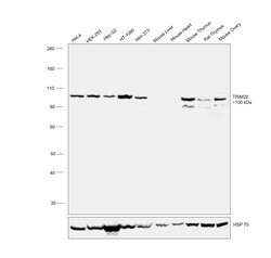 TRIM28 Polyclonal Antibody:Antibodies, Polyclonal