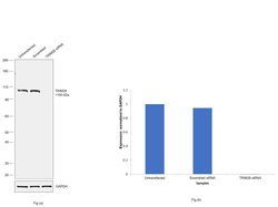 TRIM28 Polyclonal Antibody:Antibodies, Polyclonal