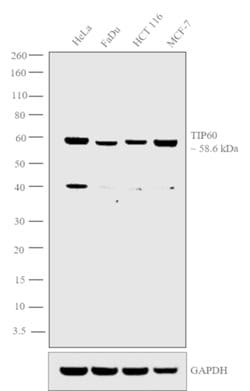 TIP60 Polyclonal Antibody:Antibodies, Polyclonal