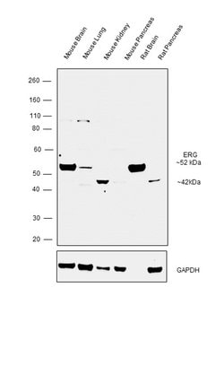 Invitrogen ERG Polyclonal Antibody 100 &mu;L | Buy Online | Invitrogen&trade; | Fisher Scientific