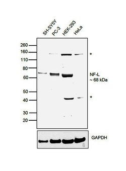 Invitrogen NEFL Polyclonal Antibody 100 &mu;L; Unconjugated:Antibodies,