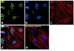 Invitrogen PARP1 Polyclonal Antibody 100 &mu;L; Unconjugated:Antibodies,