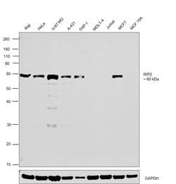 Invitrogen RIP2 Polyclonal Antibody 100 &mu;L | Buy Online | Invitrogen&trade; | Fisher Scientific