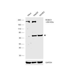 Invitrogen ROBO1 Polyclonal Antibody 100 &mu;L; Unconjugated:Antibodies,