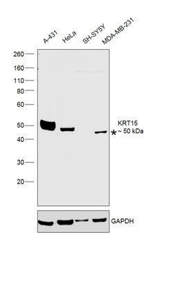 Invitrogen Cytokeratin 15 Polyclonal Antibody 100 &mu;L; Unconjugated:Antibodies,