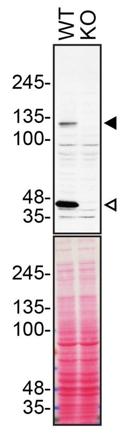 Invitrogen beta Dystroglycan Polyclonal Antibody 100 &mu;L; Unconjugated:Antibodies,
