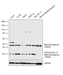 Invitrogen beta Dystroglycan Polyclonal Antibody 100 &mu;L; Unconjugated:Antibodies,