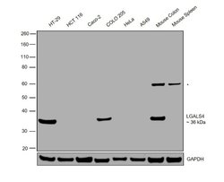 Invitrogen Galectin 4 Polyclonal Antibody 100 &mu;L; Unconjugated:Antibodies,