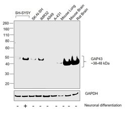 Invitrogen GAP43 Polyclonal Antibody 100 &mu;L; Unconjugated:Antibodies,