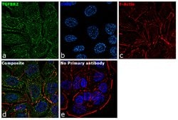 Invitrogen TGFBR2 Polyclonal Antibody 400 &mu;L; Unconjugated:Antibodies,