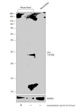 Invitrogen Phospho-Cardiac Troponin I (Ser23, Ser24) Polyclonal Antibody 100 &mu;L | Buy Online | Invitrogen&trade; | Fisher Scientific