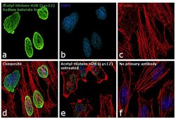 Invitrogen H2BK12ac Polyclonal Antibody 50 &mu;g; Unconjugated:Antibodies,