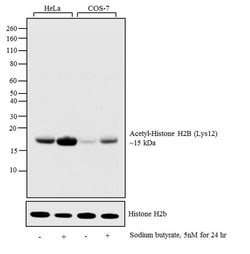 Invitrogen H2BK12ac Polyclonal Antibody 50 &mu;g; Unconjugated:Antibodies,