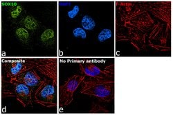 Invitrogen SOX10 Polyclonal Antibody 100 &mu;L | Buy Online | Invitrogen&trade; | Fisher Scientific