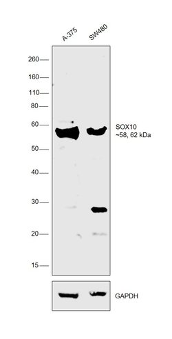 Invitrogen SOX10 Polyclonal Antibody 100 &mu;L | Buy Online | Invitrogen&trade; | Fisher Scientific