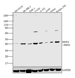 Invitrogen SRSF6 Polyclonal Antibody 100 &mu;L; Unconjugated:Antibodies,
