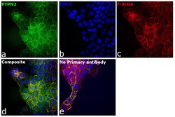 PTPN2 Polyclonal Antibody, Invitrogen 100 &mu;L; Unconjugated:Antibodies,
