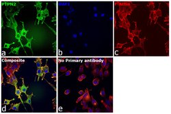 PTPN2 Polyclonal Antibody, Invitrogen 100 &mu;L; Unconjugated:Antibodies,