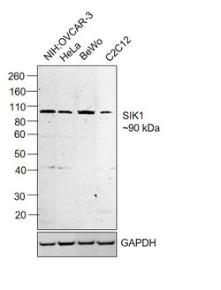 Invitrogen SIK1 Polyclonal Antibody 100 &mu;L; Unconjugated:Antibodies,
