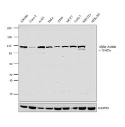 alpha Actinin 1 Polyclonal Antibody:Antibodies, Polyclonal