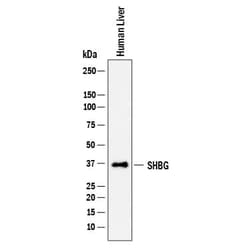 Invitrogen SHBG Polyclonal Antibody 100 &mu;g; Unconjugated:Antibodies,