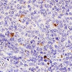 Invitrogen IL-2 Polyclonal Antibody 100 &mu;g; Unconjugated:Antibodies,
