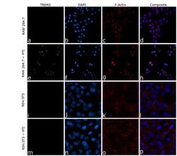 Invitrogen&trade;&nbsp;TREM2 Polyclonal Antibody