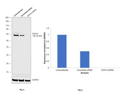 Invitrogen SOX10 Polyclonal Antibody 100 &mu;g; Unconjugated:Antibodies,