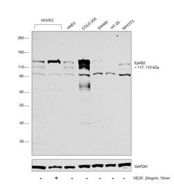 Invitrogen EphB2 Polyclonal Antibody 100 &mu;g; Unconjugated:Antibodies,