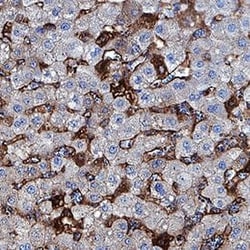 Invitrogen ST2 Polyclonal Antibody 100 &mu;g; Unconjugated:Anticuerpos
