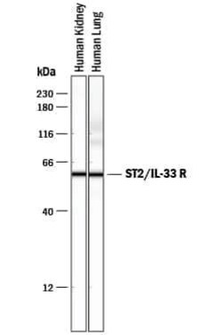 Invitrogen ST2 Polyclonal Antibody 100 &mu;g; Unconjugated:Anticuerpos