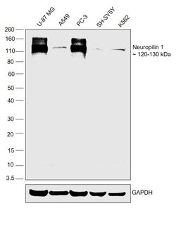 Invitrogen Neuropilin 1 Polyclonal Antibody 100 &mu;g | Buy Online | Invitrogen&trade; | Fisher Scientific