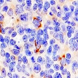 Invitrogen CD137 Polyclonal Antibody 100 &mu;g; Unconjugated:Antibodies,
