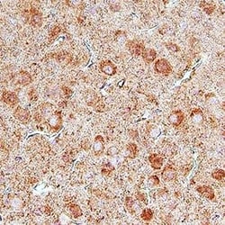 Invitrogen UNC5B Polyclonal Antibody 100 &mu;g | Buy Online | Invitrogen&trade; | Fisher Scientific