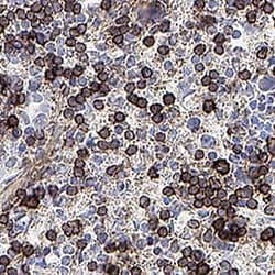 Invitrogen IL17RB Polyclonal Antibody 100 &mu;g | Buy Online | Invitrogen&trade; | Fisher Scientific