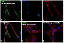 CD10 Polyclonal Antibody, Invitrogen 100 &mu;g; Unconjugated:Antibodies,