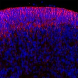 Invitrogen NOTCH3 Polyclonal Antibody 100 μg; Unconjugated:Antibodies,