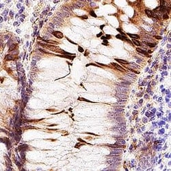 Invitrogen Carbonic Anhydrase IV Polyclonal Antibody 100 &mu;g; Unconjugated:Antikörper