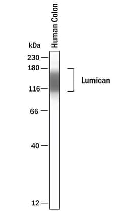 Invitrogen LUM Polyclonal Antibody 100 &mu;g; Unconjugated:Antibodies,