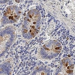 Invitrogen Kallikrein 12 Polyclonal Antibody 100 μg; Unconjugated:Antibodies,