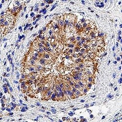 Invitrogen MIP-3 alpha Polyclonal Antibody 100 &mu;g; Unconjugated:Antibodies,