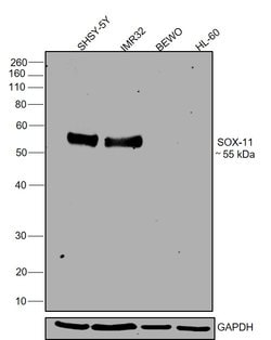 Invitrogen SOX11 Polyclonal Antibody 100 &mu;g; Unconjugated:Antibodies,